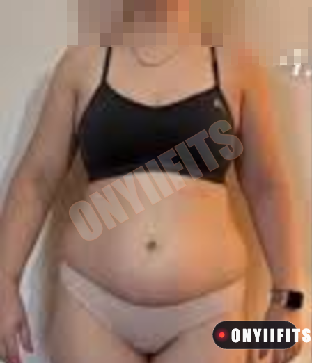 Nicole R. before, Day 1